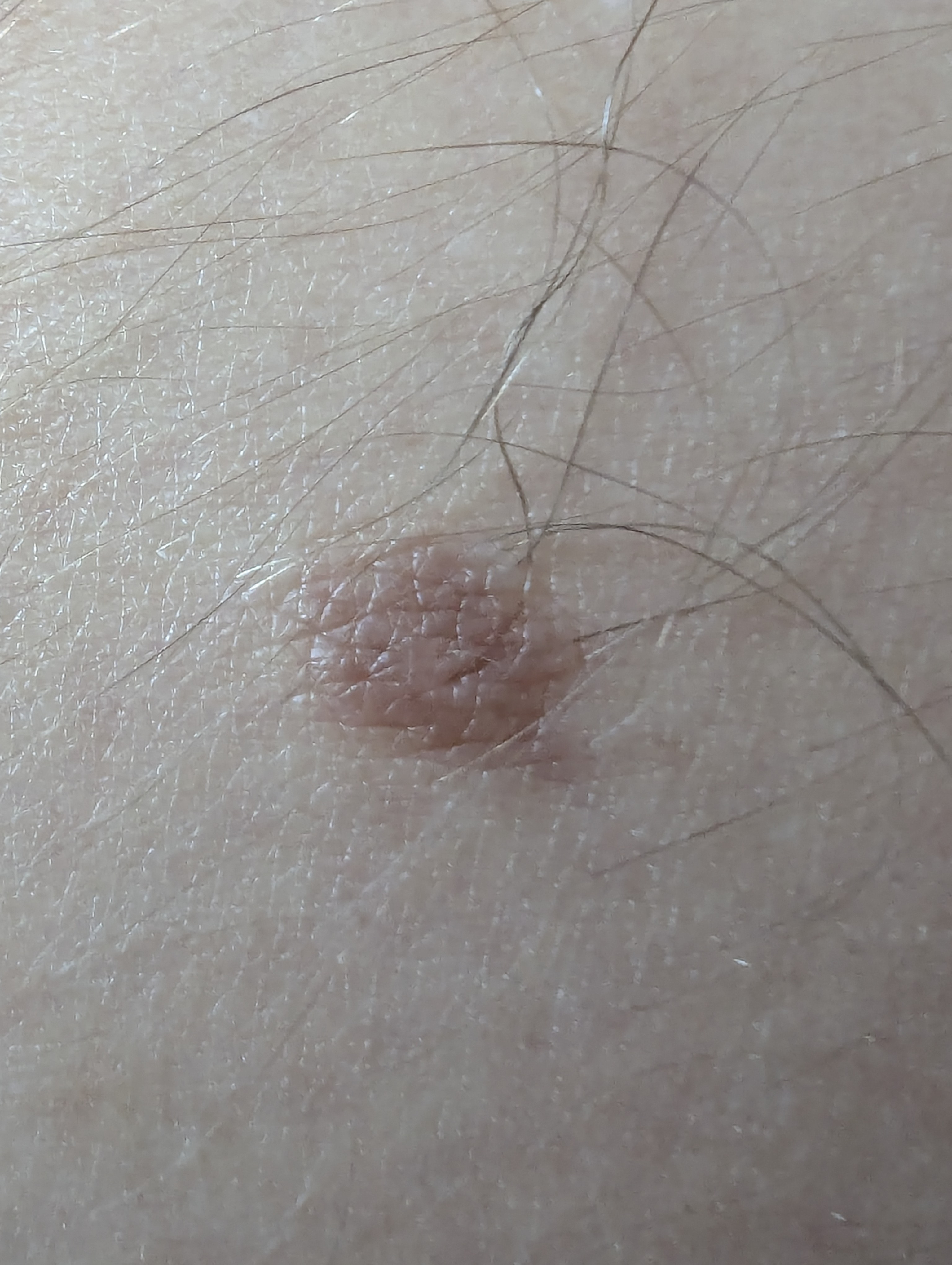 Example 2: close-up with good focus
